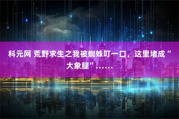 科元网 荒野求生之我被蜘蛛叮一口，这里堵成“大象腿”……